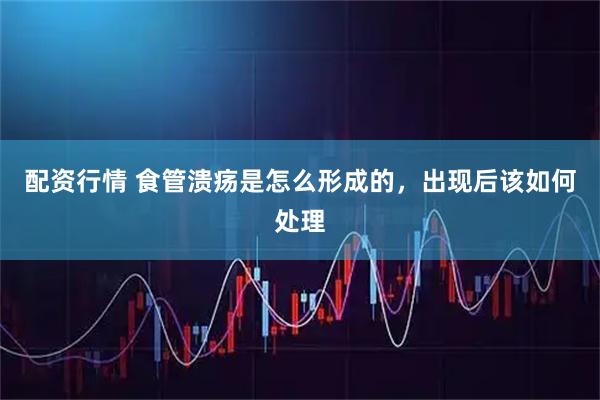 配资行情 食管溃疡是怎么形成的，出现后该如何处理